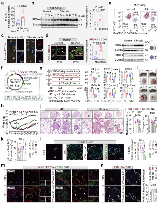 Peroxiredoxin 4 as a switch regulating PTEN/AKT axis in alveolar macrophages activation