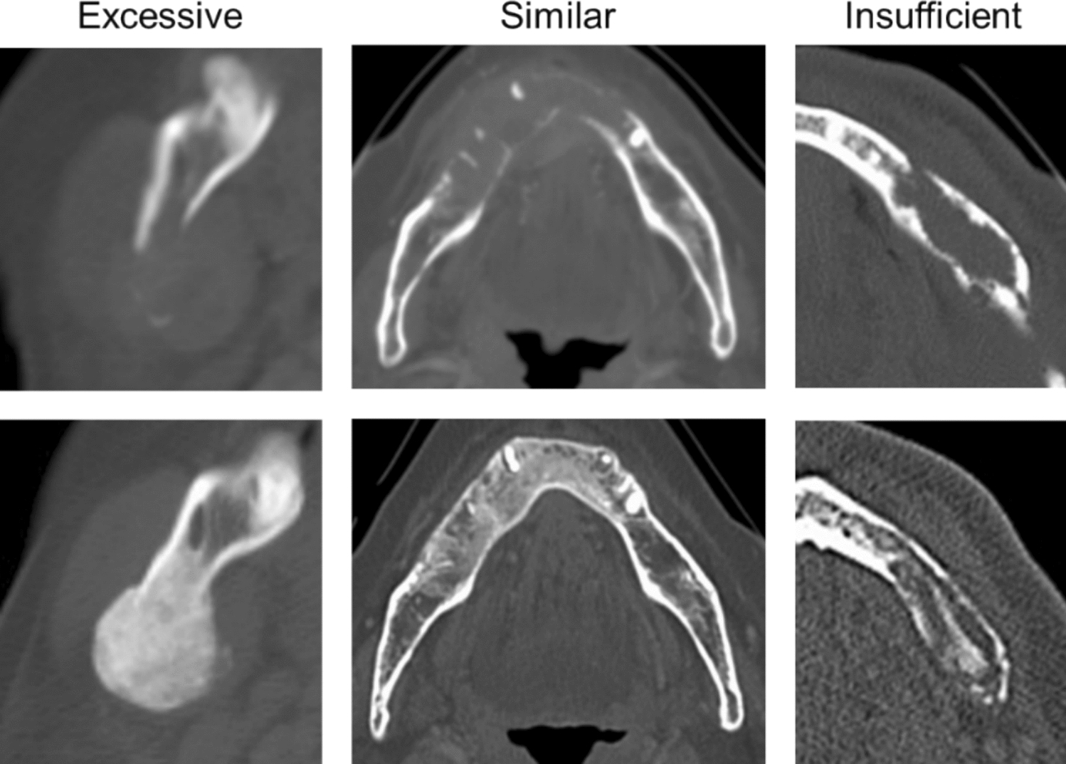 Clinical factors associated with jawbone remineralization after nonsurgical treatment and imaging-based insights into its processes
