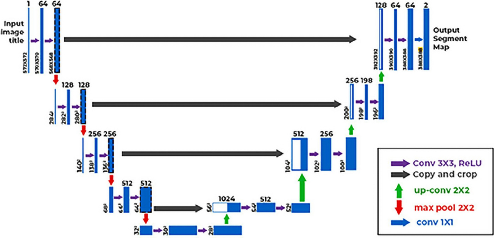 U-net-based segmentation of foreign bodies and ghost images in panoramic radiographs