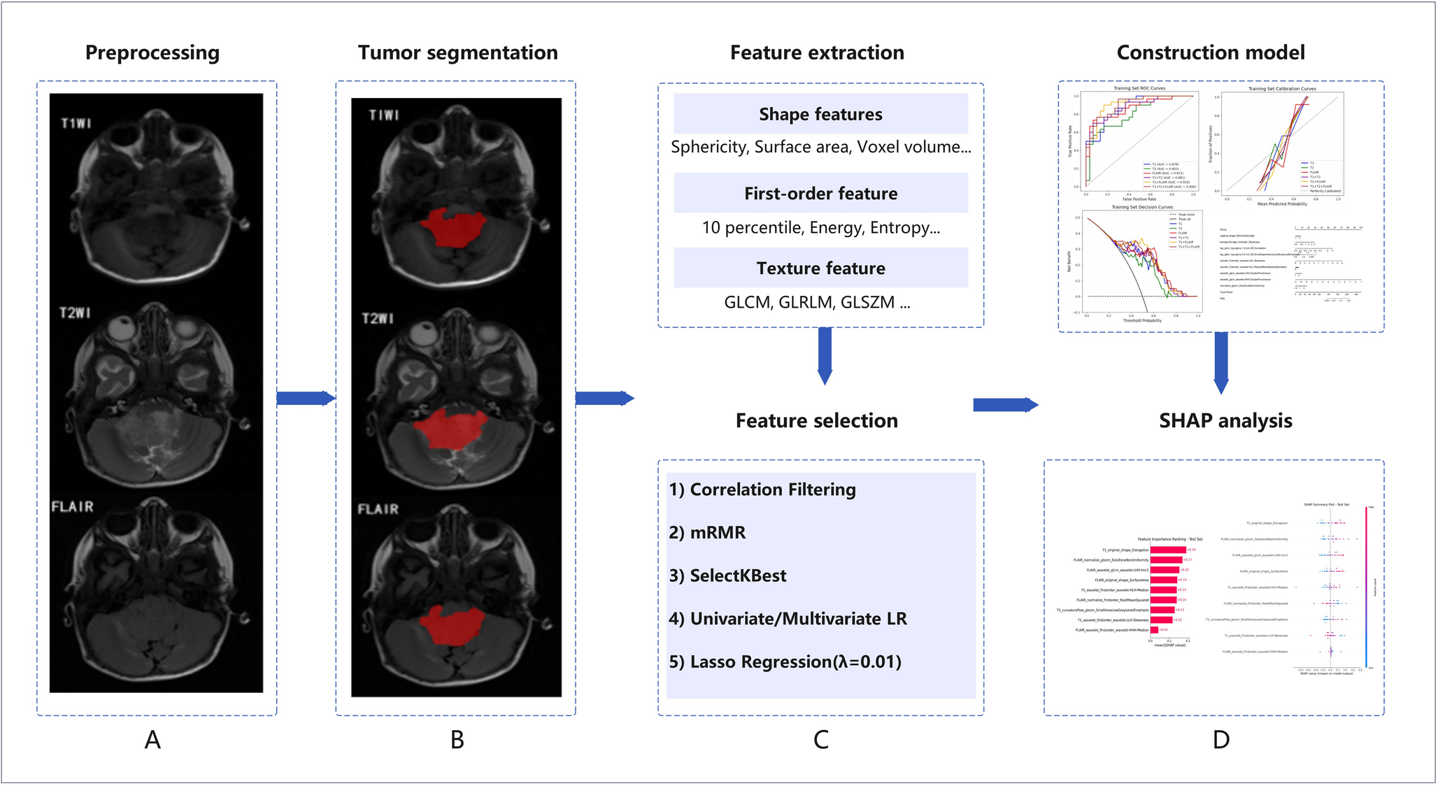 A predictive model for differentiating PFA and PFB subtypes of posterior fossa ependymoma using multi-sequence MRI radiomics: a two-center study