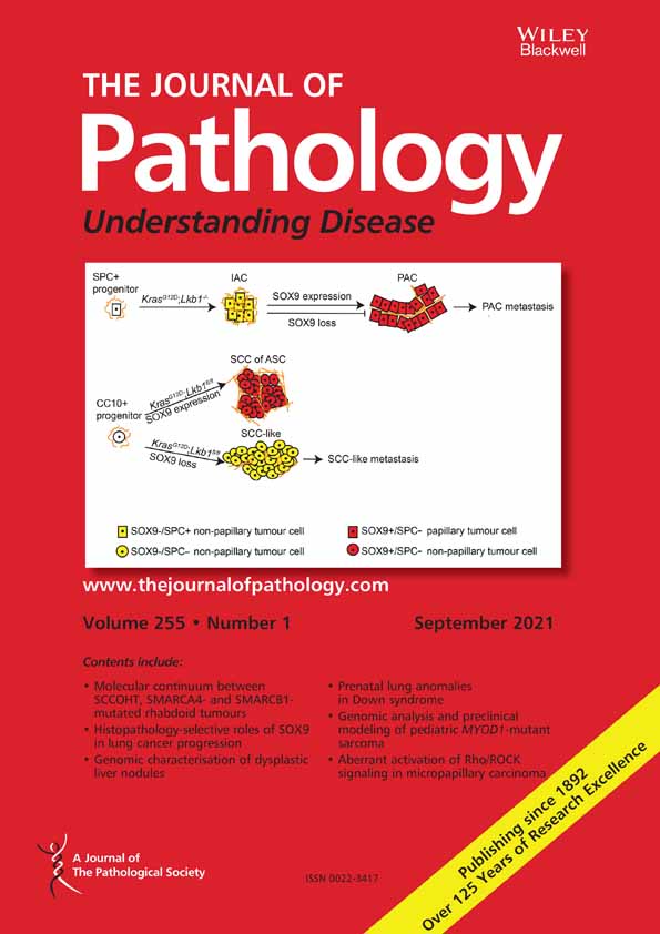 Disordered farnesoid X receptor signaling is associated with liver carcinogenesis in Abcb11‐deficient mice
