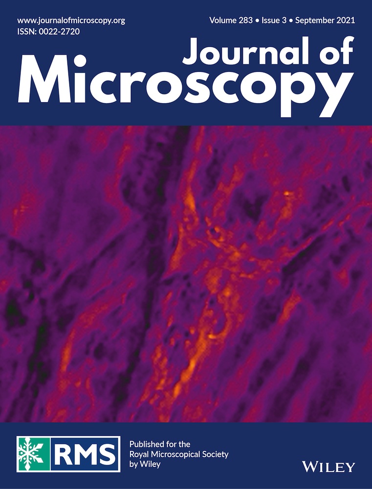 Correlative Light and Volume Electron Microscopy (vCLEM): How Community Participation Can Advance Developing Technologies