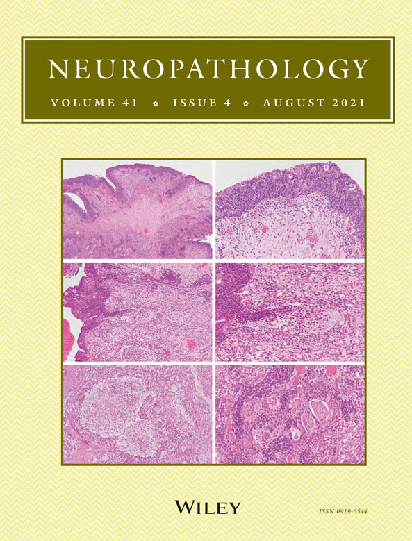 LINC01123 potentially correlates with radioresistance in glioma through the miR‐151a/CENPB axis