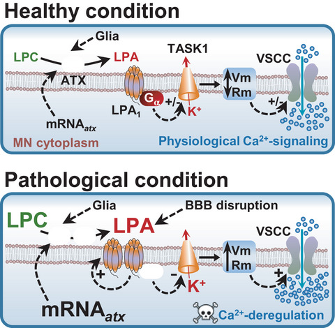 Targeting autotaxin impacts disease advance in the SOD1‐G93A mouse model of amyotrophic lateral sclerosis