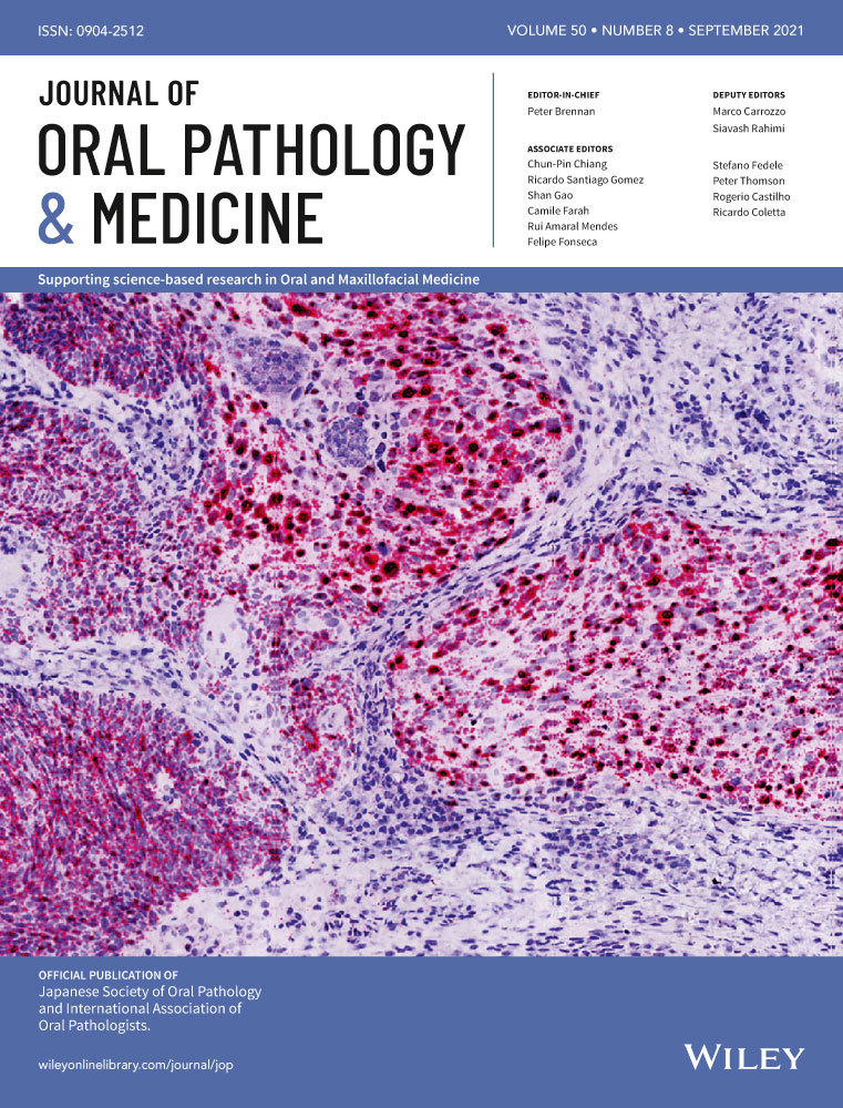 Cephaeline is an inductor of histone H3 acetylation and inhibitor of mucoepidermoid carcinoma cancer stem cells