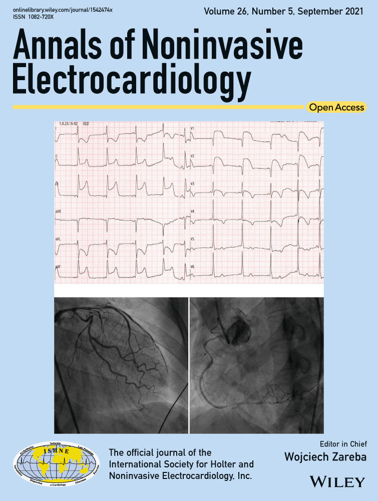 Reversible, regional ST‐segment elevation due to chylothorax