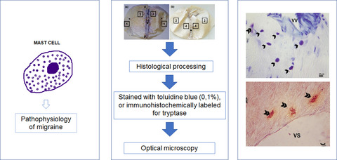 Histomorphometry of mast cells in the convexity of human intracranial dura mater