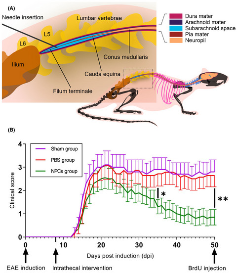 Lumbar spine intrathecal transplantation of neural precursor cells promotes oligodendrocyte proliferation in hot spots of chronic demyelination