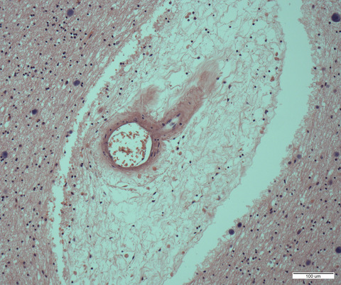 Correlations in post‐mortem imaging‐histopathology studies of sporadic human cerebral small vessel disease: A systematic review