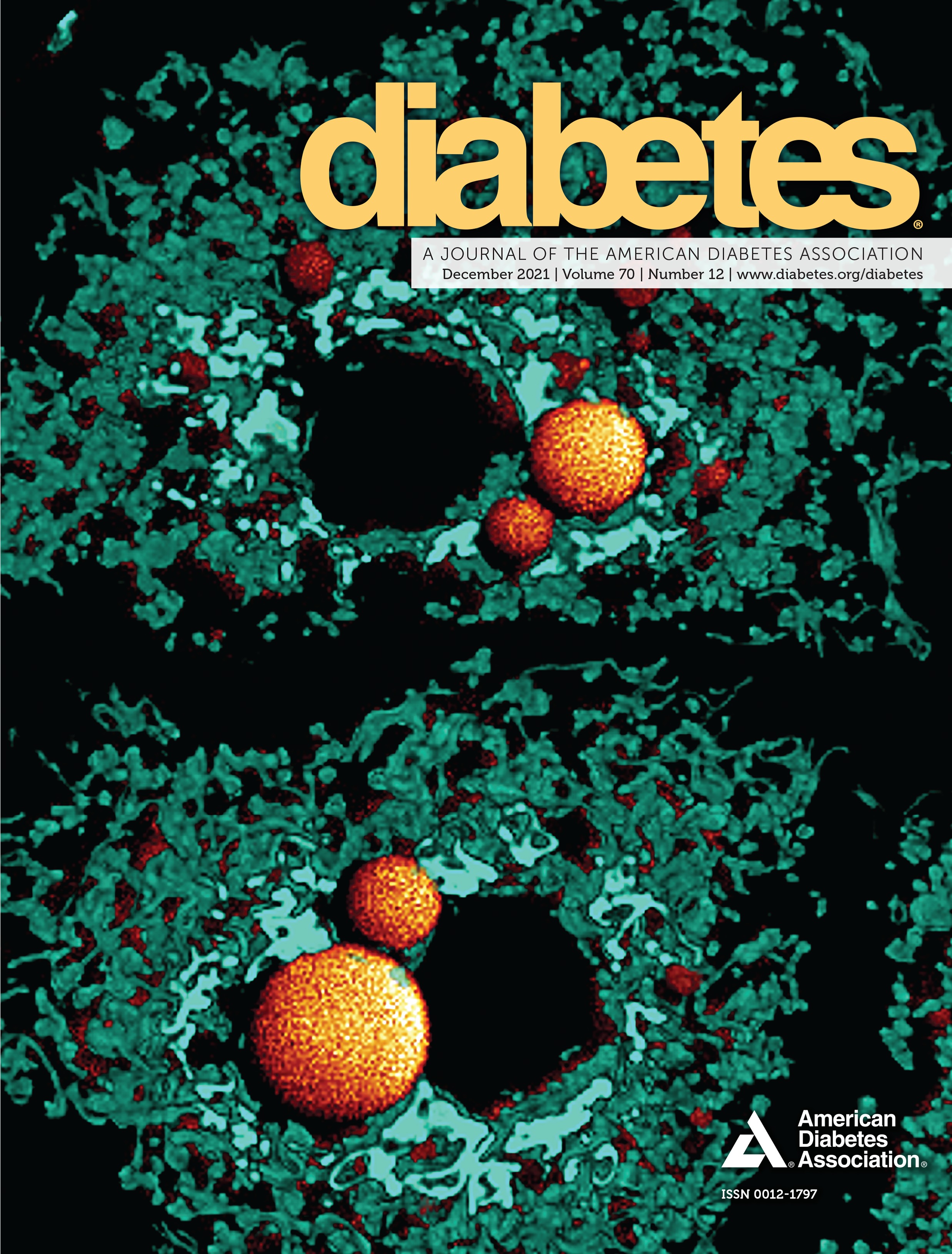 Coxsackievirus B Vaccines Prevent Infection-Accelerated Diabetes in NOD Mice and Have No Disease-Inducing Effect