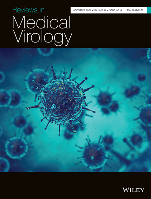 Complement inhibition: A possible therapeutic approach in the fight against Covid‐19