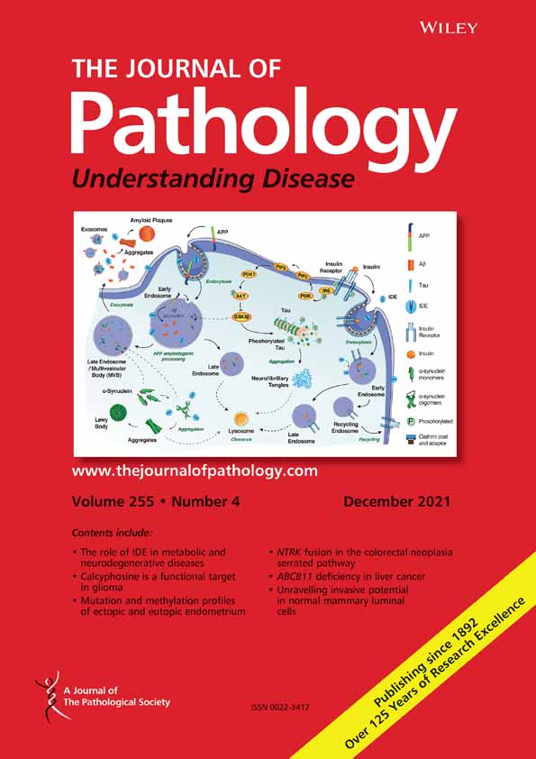 NLRP3 inflammasome as a key molecular target underlying cognitive resilience in amyotrophic lateral sclerosis