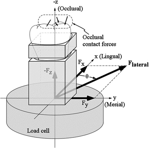 The effects of a periodontal ligament analogue on occlusal contact forces