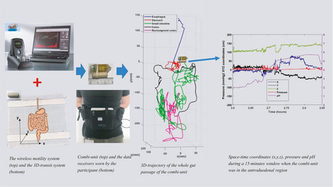 Contractility patterns and gastrointestinal movements monitored by a combined magnetic tracking and motility testing unit
