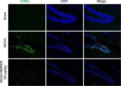 BMPER alleviates ischemic brain injury by protecting neurons and inhibiting neuroinflammation via Smad3‐Akt‐Nrf2 pathway