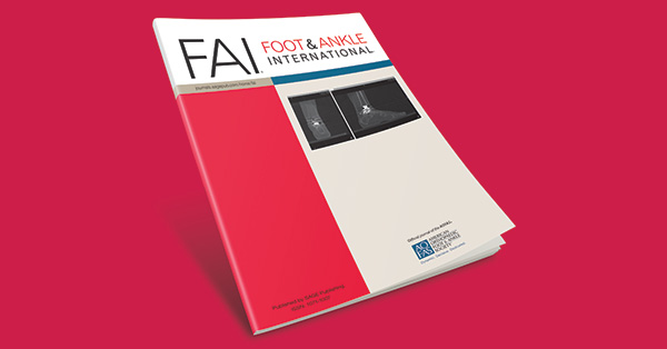 Anatomically Fixed Posterior Malleolar Fractures in Syndesmosis Injuries without Transsyndesmotic Screw Fixation