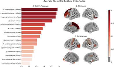 Predicting alcohol dependence from multi‐site brain structural measures