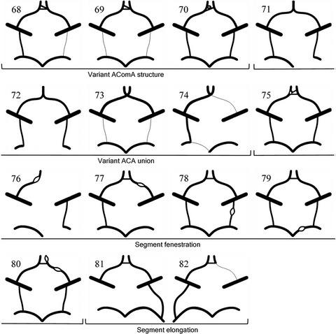 A new classification system for the anatomical variations of the human circle of Willis: A systematic review