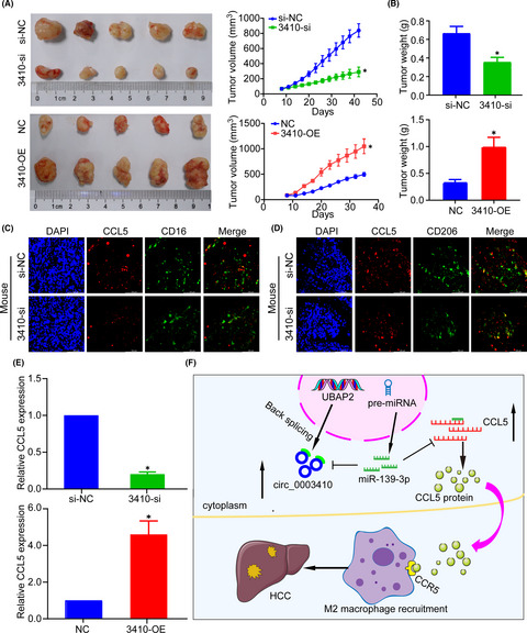 hsa_circ_0003410 promotes hepatocellular carcinoma progression by increasing the ratio of M2/M1 macrophages through the miR‐139‐3p/CCL5 axis