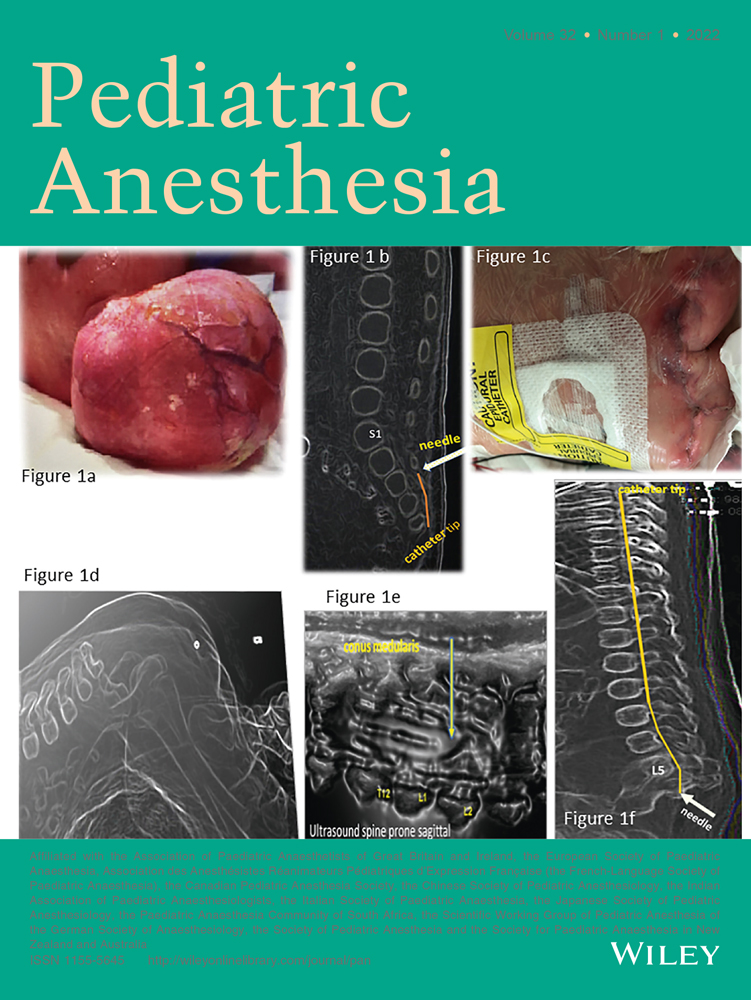 A Novel Approach to Operating Room Readiness for Airborne Precautions Using Simulation‐Based Clinical Systems Testing