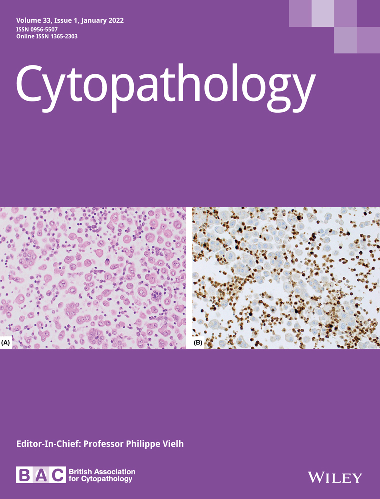 An Effective Approach for BRAF V600E Mutation Analysis of Routine Thyroid Fine Needle Aspirates