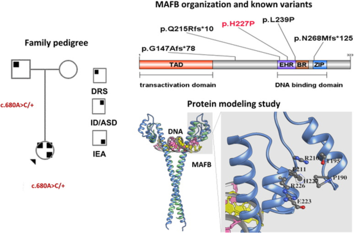 Duane retraction syndrome characterized by inner ear agenesis and neurodevelopmental phenotype in an Italian family with a variant in MAFB