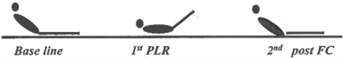 Electrical Cardiometry Versus Carotid Doppler in Assessment of Fluid Responsiveness in Critically Ill Septic Patients