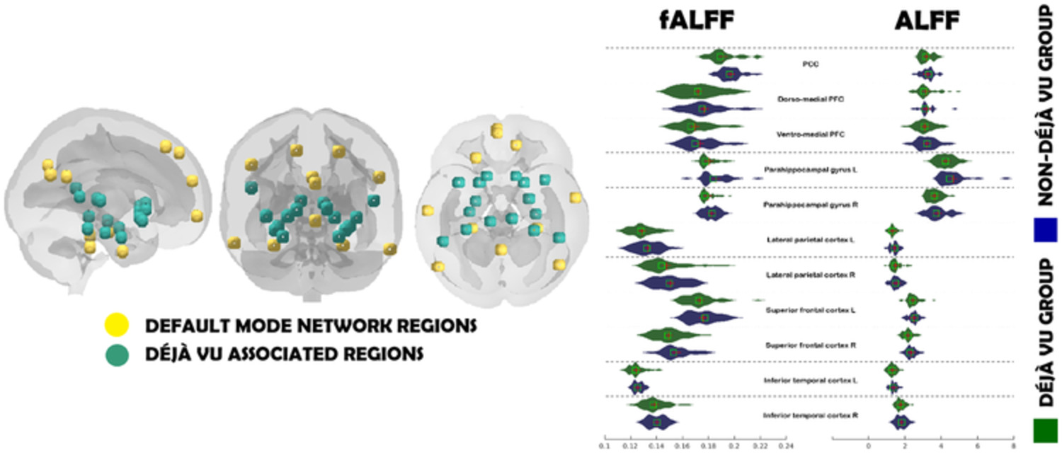 Insights into déjà vu: Associations between the frequency of experience and amplitudes of low‐frequency oscillations in resting‐state functional magnetic resonance imaging