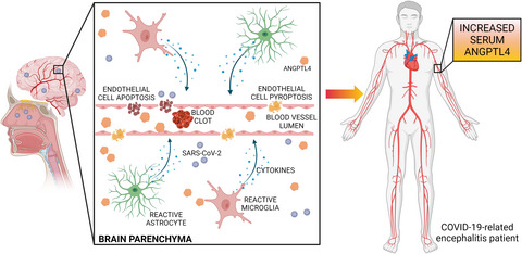 Catching hold of COVID‐19‐related encephalitis by tracking ANGPTL4 signature in blood