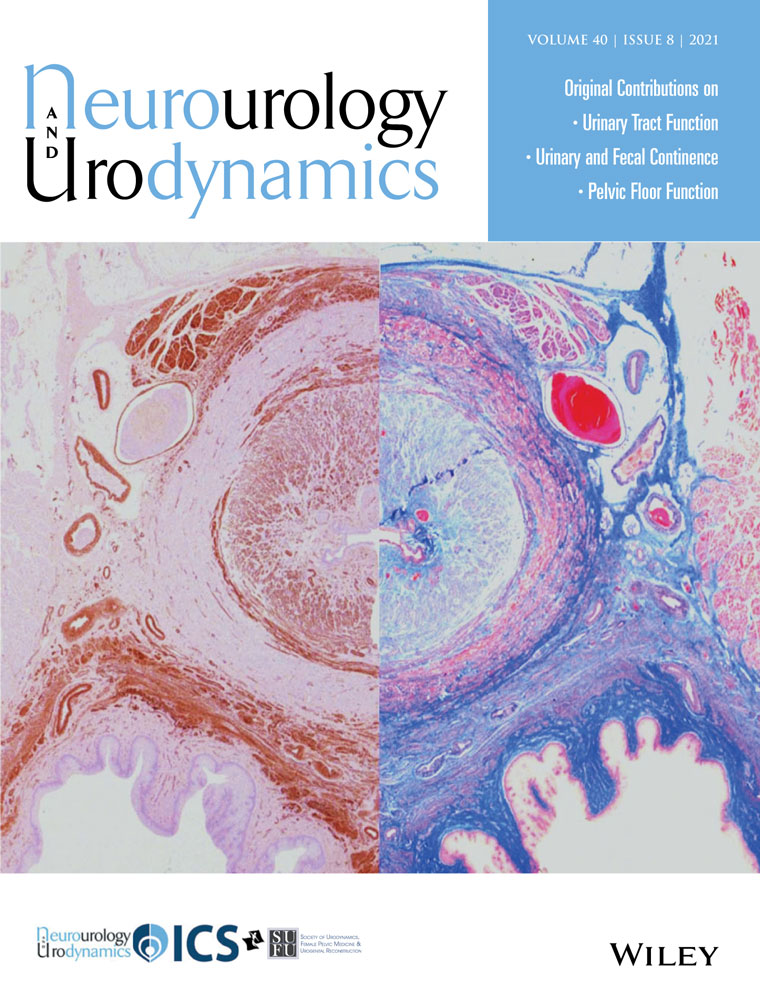 Influence of ATOMS implant on the voiding phase of patients with post‐prostatectomy urinary incontinence