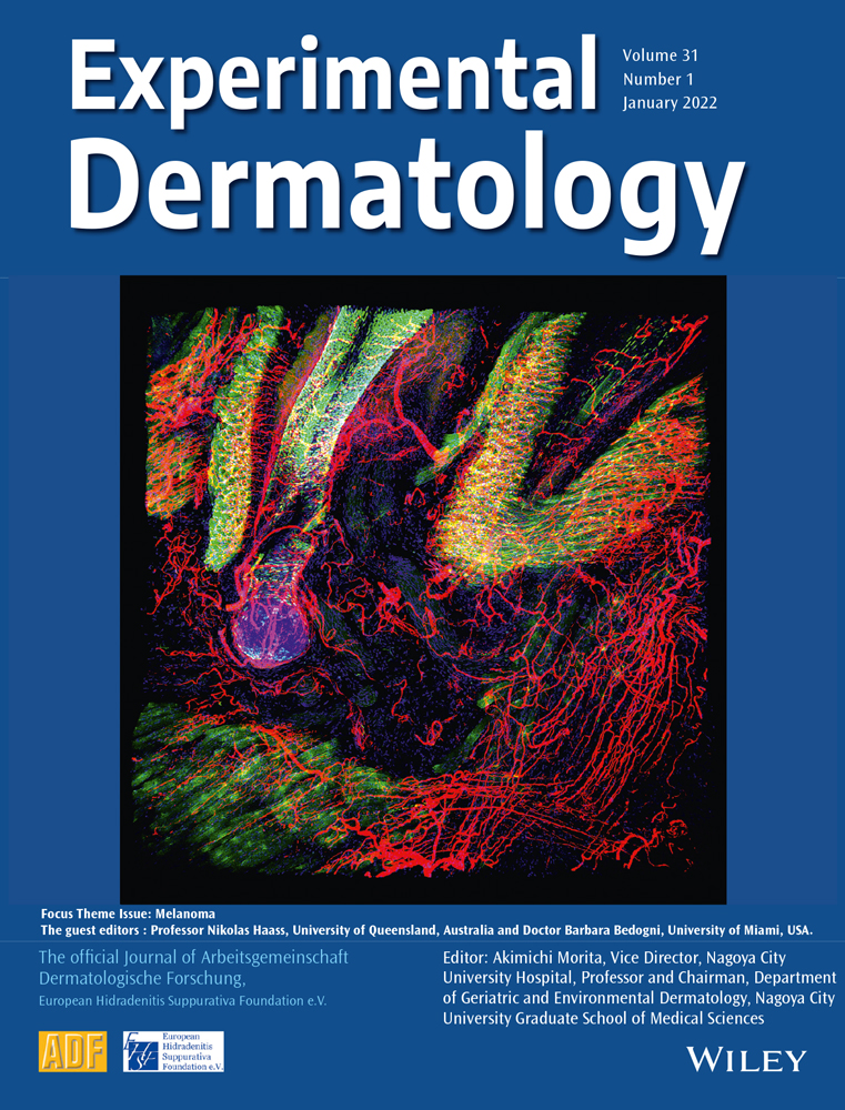 Melanoma brain metastases: Biological basis and novel therapeutic strategies