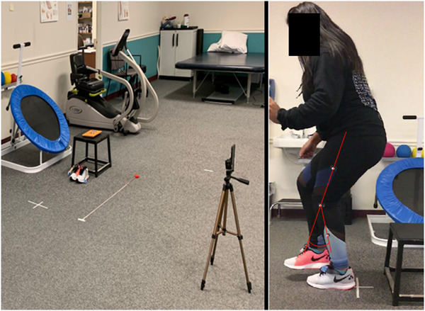 Landing biomechanics deficits in anterior cruciate ligament reconstruction patients can be assessed in a non‐laboratory setting