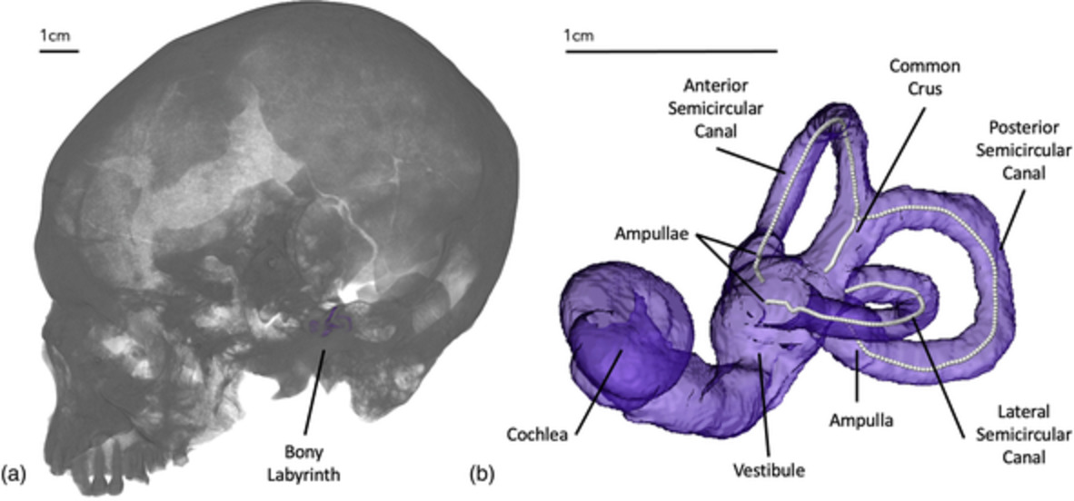 The influence of subsistence strategy and climate on bony labyrinth morphology in recent Homo sapiens