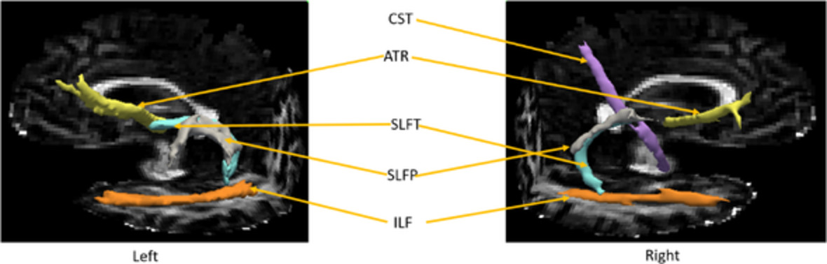 Financial decision‐making and self‐awareness for financial decision‐making is associated with white matter integrity in older adults