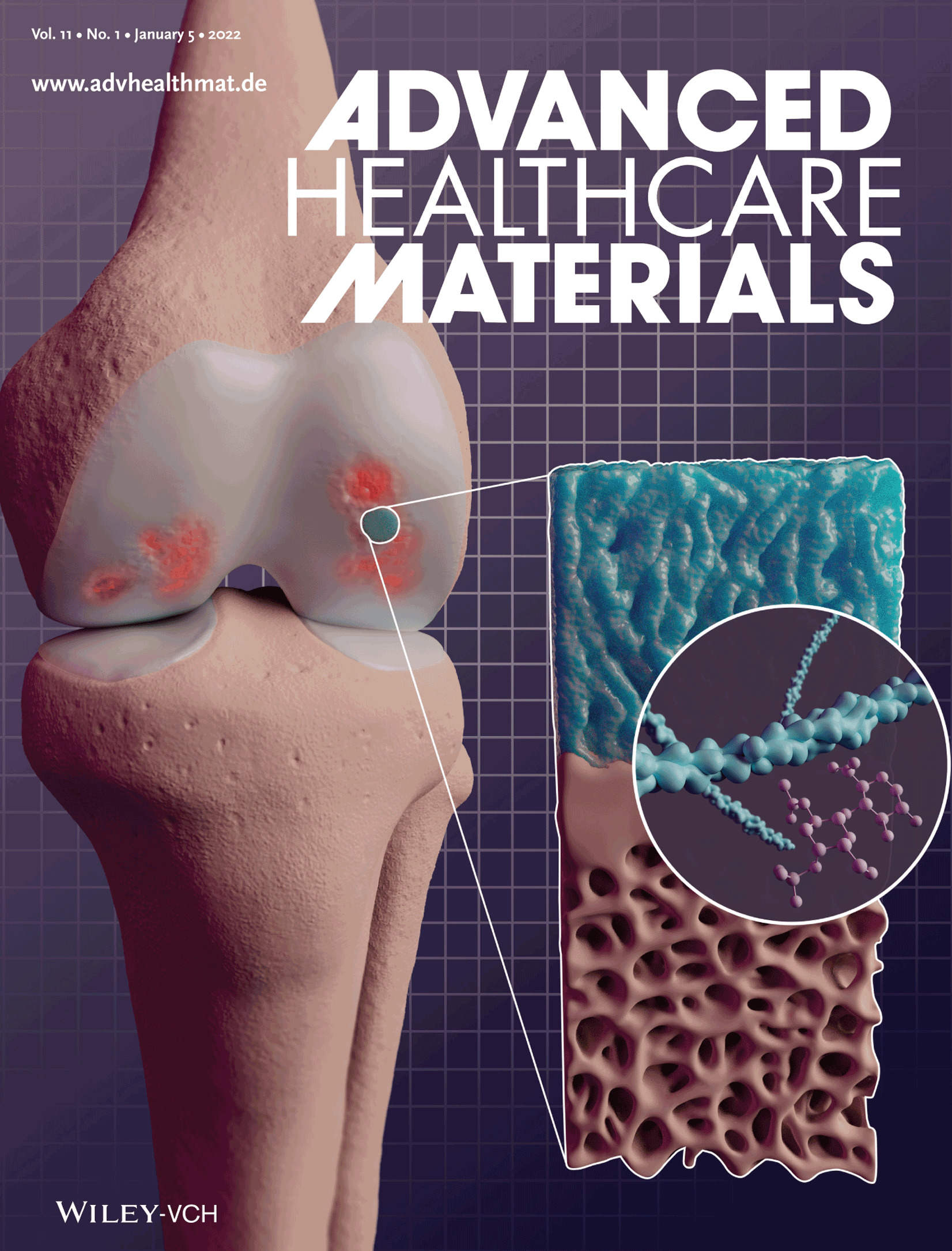 Biomimetic Scaffolds Modulate the Posttraumatic Inflammatory Response in Articular Cartilage Contributing to Enhanced Neoformation of Cartilaginous Tissue In Vivo (Adv. Healthcare Mater. 1/2022)