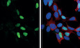 RNA sensing via the RIG‐I‐like receptor LGP2 is essential for the induction of a type I IFN response in ADAR1 deficiency
