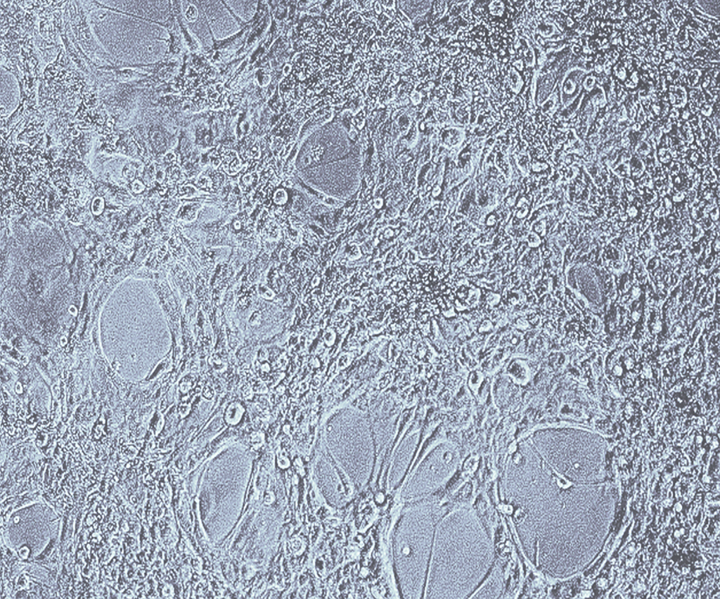 An insight into the iPSCs-derived two-dimensional culture and three-dimensional organoid models for neurodegenerative disorders