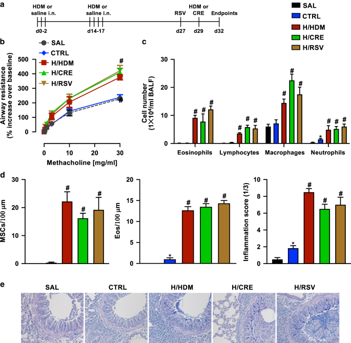 Single-cell RNA transcriptomic analysis identifies Creb5 and CD11b-DCs as regulator of asthma exacerbations