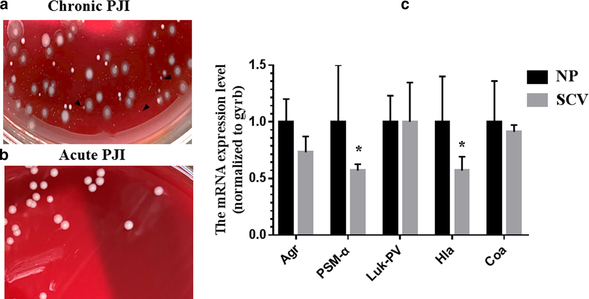 The role of Staphylococcus aureus small colony variants in intraosseous invasion and colonization in periprosthetic joint infection
