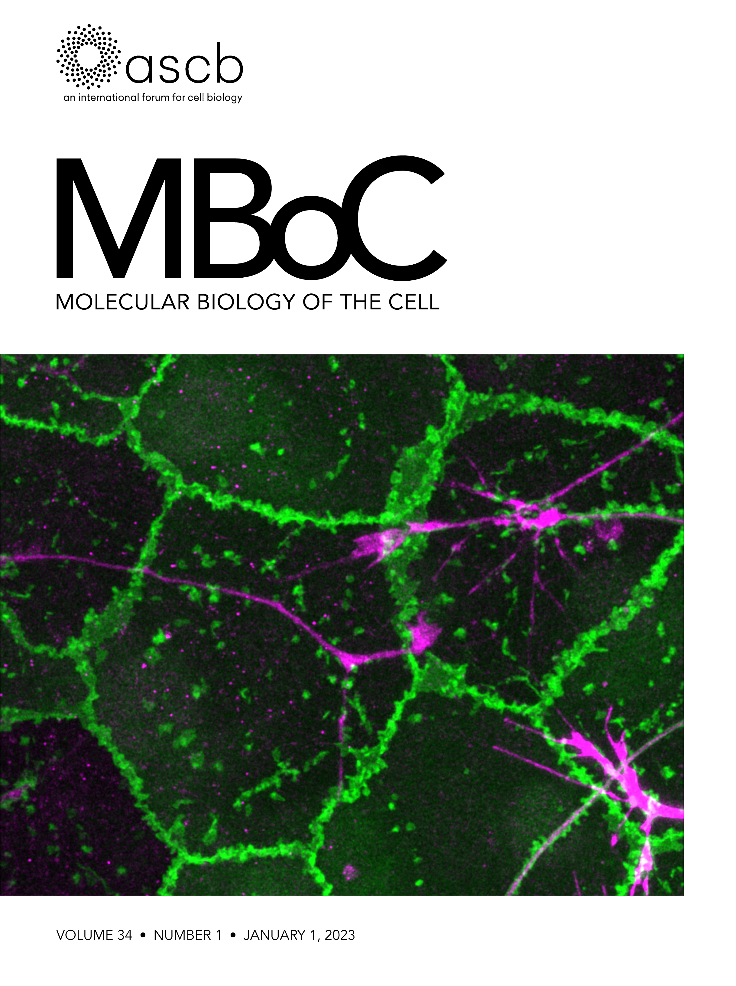 Preprint Highlight: A lysosomal lipid transport pathway that enables cell survival under choline limitation