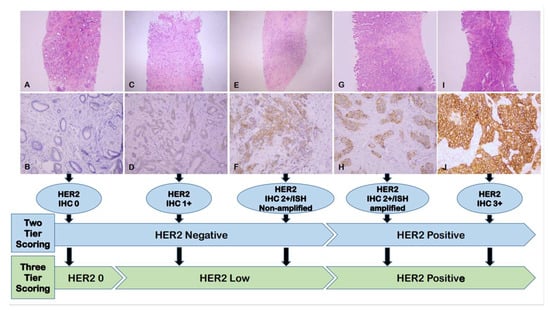 Cancers, Vol. 15, Pages 126: Current Biological, Pathological and Clinical Landscape of HER2-Low Breast Cancer
