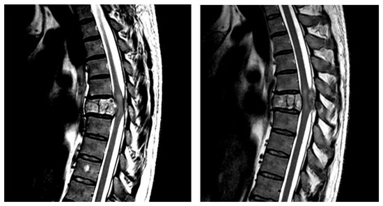 Cells, Vol. 12, Pages 120: Molecular Mechanisms and Clinical Application of Multipotent Stem Cells for Spinal Cord Injury