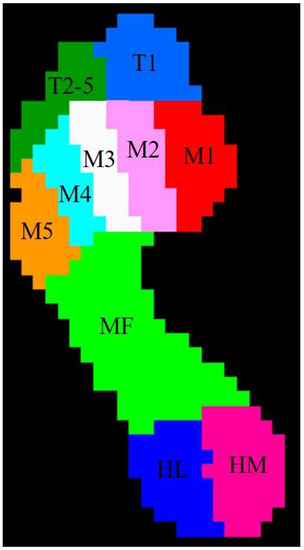 Medicina, Vol. 59, Pages 59: Comparison of Walking Quality Variables between End-Stage Osteonecrosis of Femoral Head Patients and Healthy Subjects by a Footscan Plantar Pressure System
