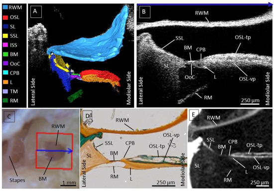 JCM, Vol. 12, Pages 238: Optical Coherence Tomography-Based Atlas of the Human Cochlear Hook Region