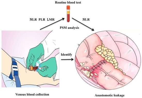 JPM, Vol. 13, Pages 93: Neutrophil-to-Lymphocyte Ratio as an Early Predictor of Symptomatic Anastomotic Leakage in Patients after Rectal Cancer Surgery: A Propensity Score-Matched Analysis
