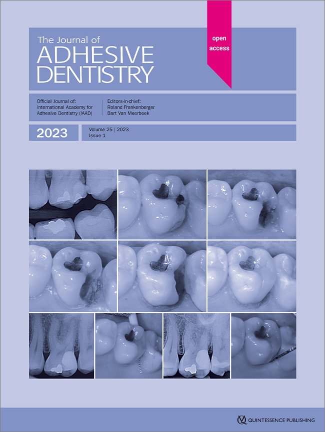 The Effect of Nano-Silica Surface Infiltration on Bond Strength of a Phosphate-Monomer–containing ﻿Composite Cement to Zirconia