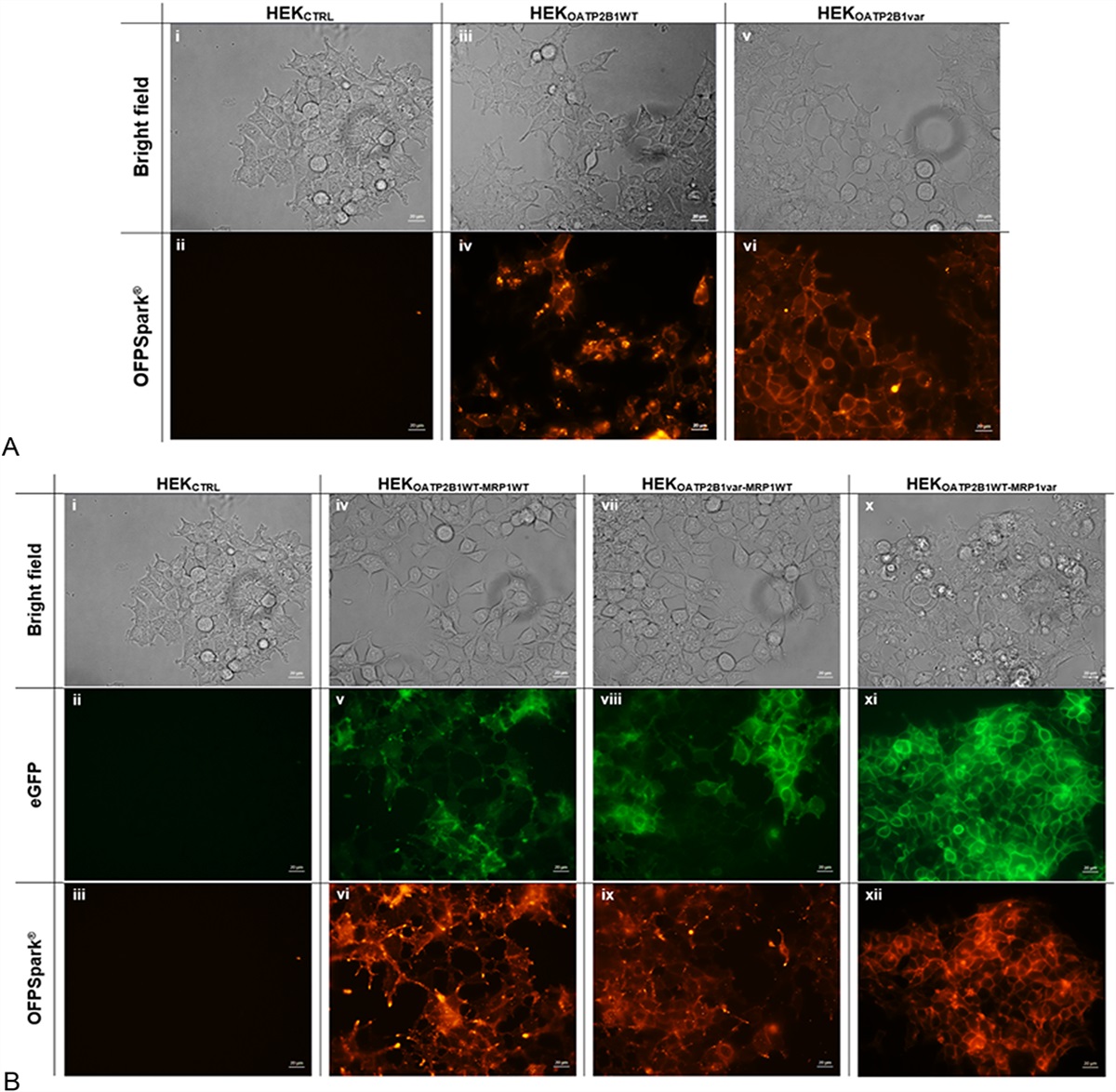 Genetic Polymorphisms in SLCO2B1 and ABCC1 Conjointly Modulate Atorvastatin Intracellular Accumulation in HEK293 Recombinant Cell Lines