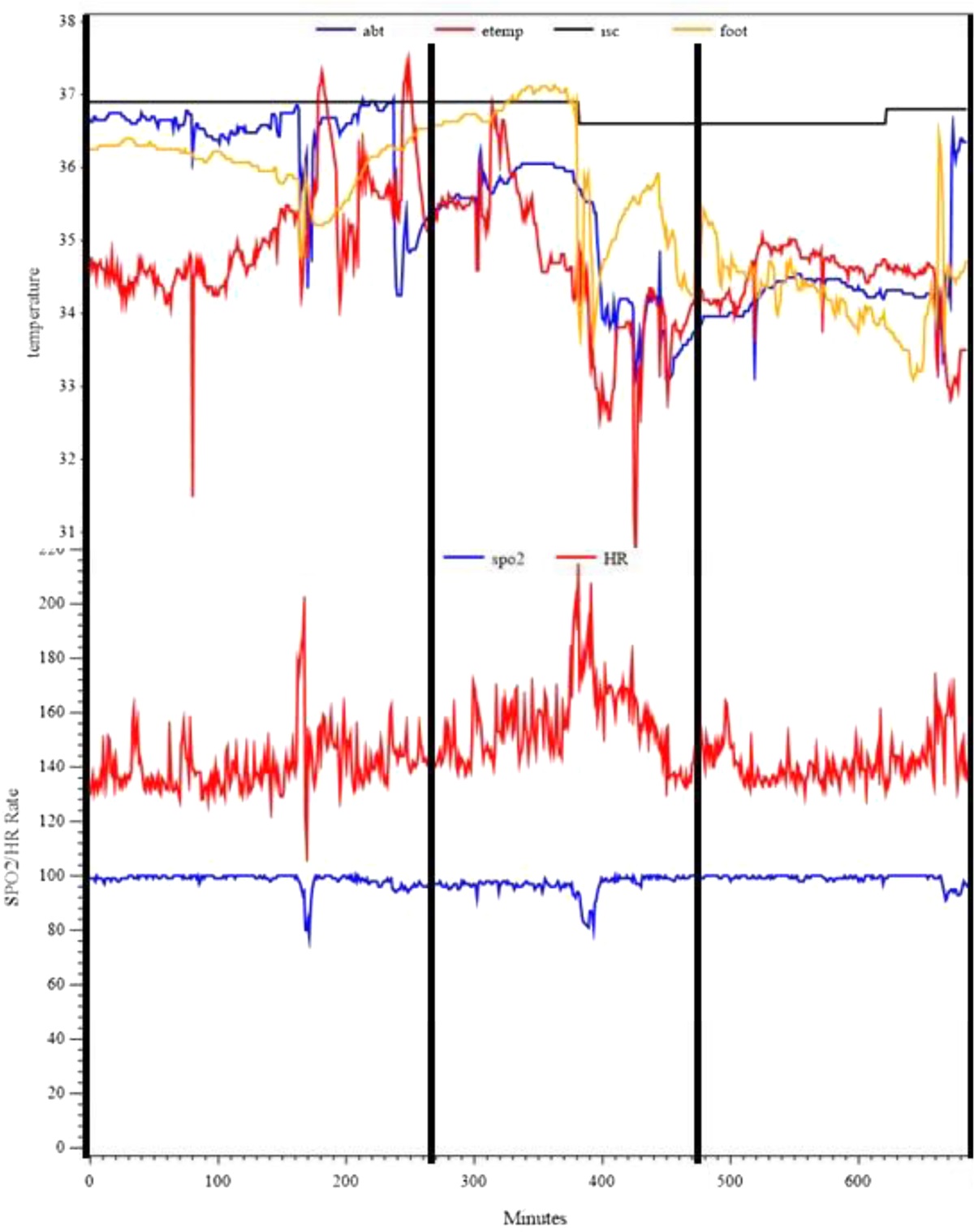 Case Comparison of Preterm Infant Stability During Packed Red Blood Cell Transfusions