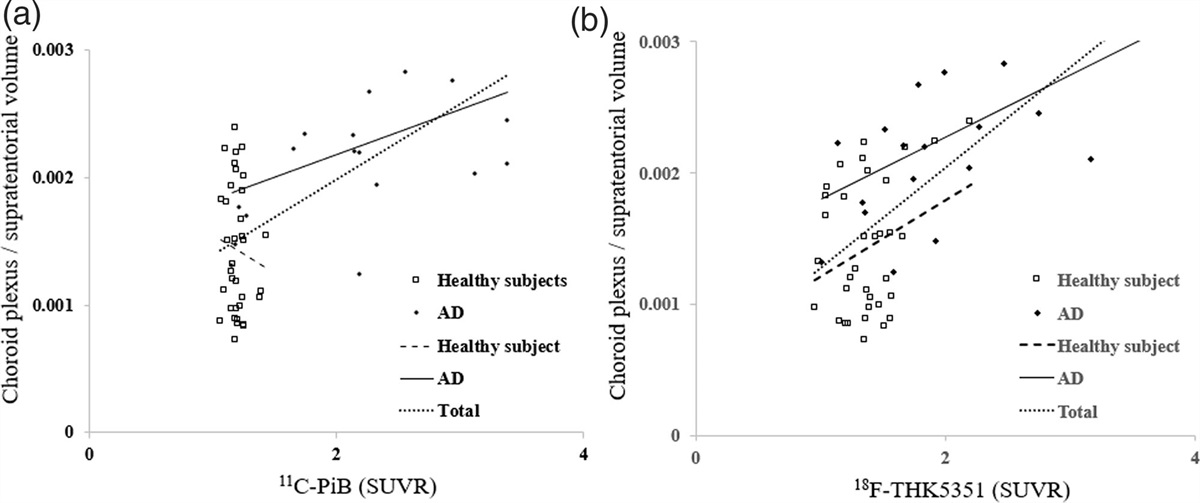 Relationship between the tau protein and choroid plexus volume in Alzheimer’s disease