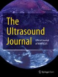 Simultaneous venous–arterial Doppler during preload augmentation: illustrating the Doppler Starling curve